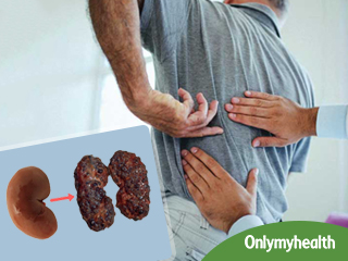 किडनी को बीमारियों और पथरी से है बचाना तो रोजाना करें ये 1 काम